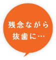 残念ながら抜歯に…